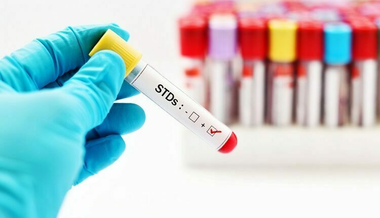 STDs